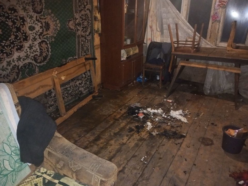 В Кирове заядлый курильщик получил ожоги, закурив в постели и уснув с непотушенной сигаретой