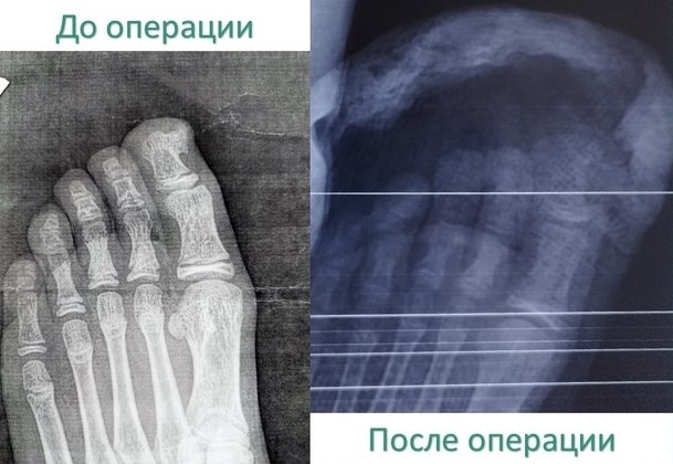 Минздрав Кировской области